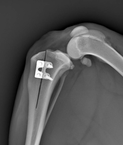 Rapid Luxation_Dr.Petagna_4
