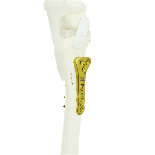 CCWO_Sawbone_2